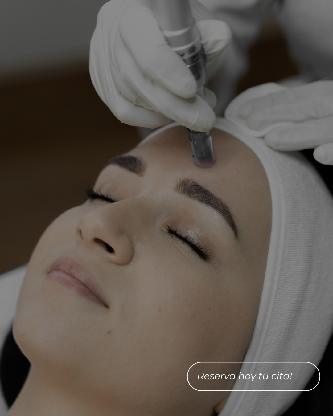 Dermapen